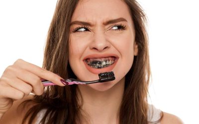 ¡Cuidado con el carbón activo! Descubre por qué puede dañar tus dientes y encías.