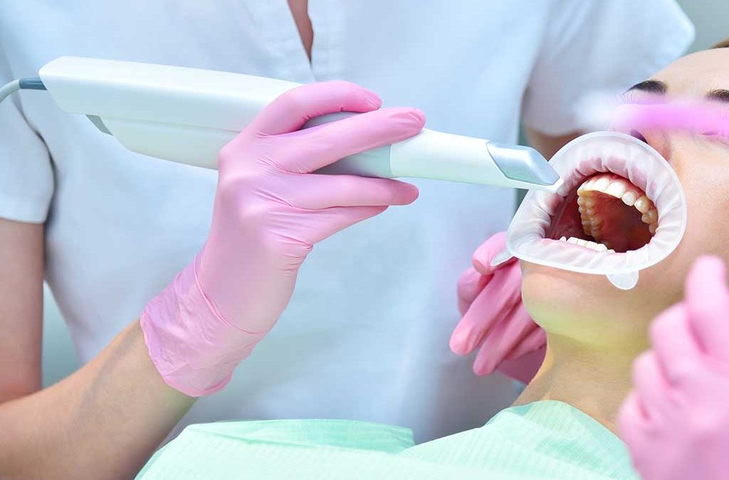 Descubre las ventajas del escáner intraoral en nuestra clínica dental en Albacete