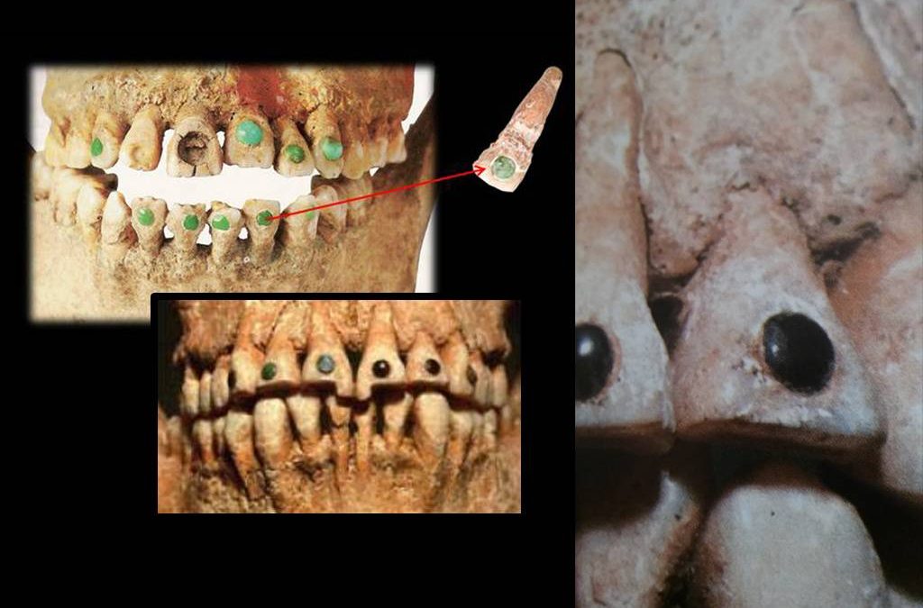 La incrustación dental de piedras preciosas: una práctica milenaria de los mayas