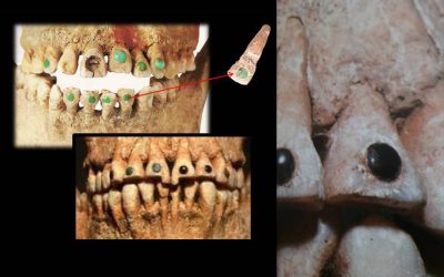 La incrustación dental de piedras preciosas: una práctica milenaria de los mayas