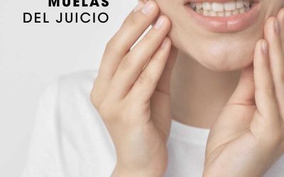 Todo lo que necesitas saber sobre las muelas del juicio en una clínica dental en Albacete