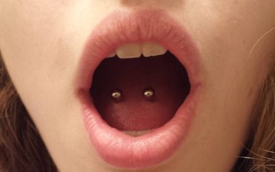 Los riesgos de los piercings en la salud oral: cicatrices, infecciones y más