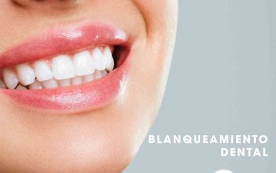 Blanqueamiento Dental: Resultados, Tipos y Cuidados