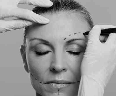 Botox en Clínica de medicina estética en Albacete Belmonte