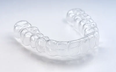 Retenedores dentales: cómo evitar que tus dientes se muevan otra vez
